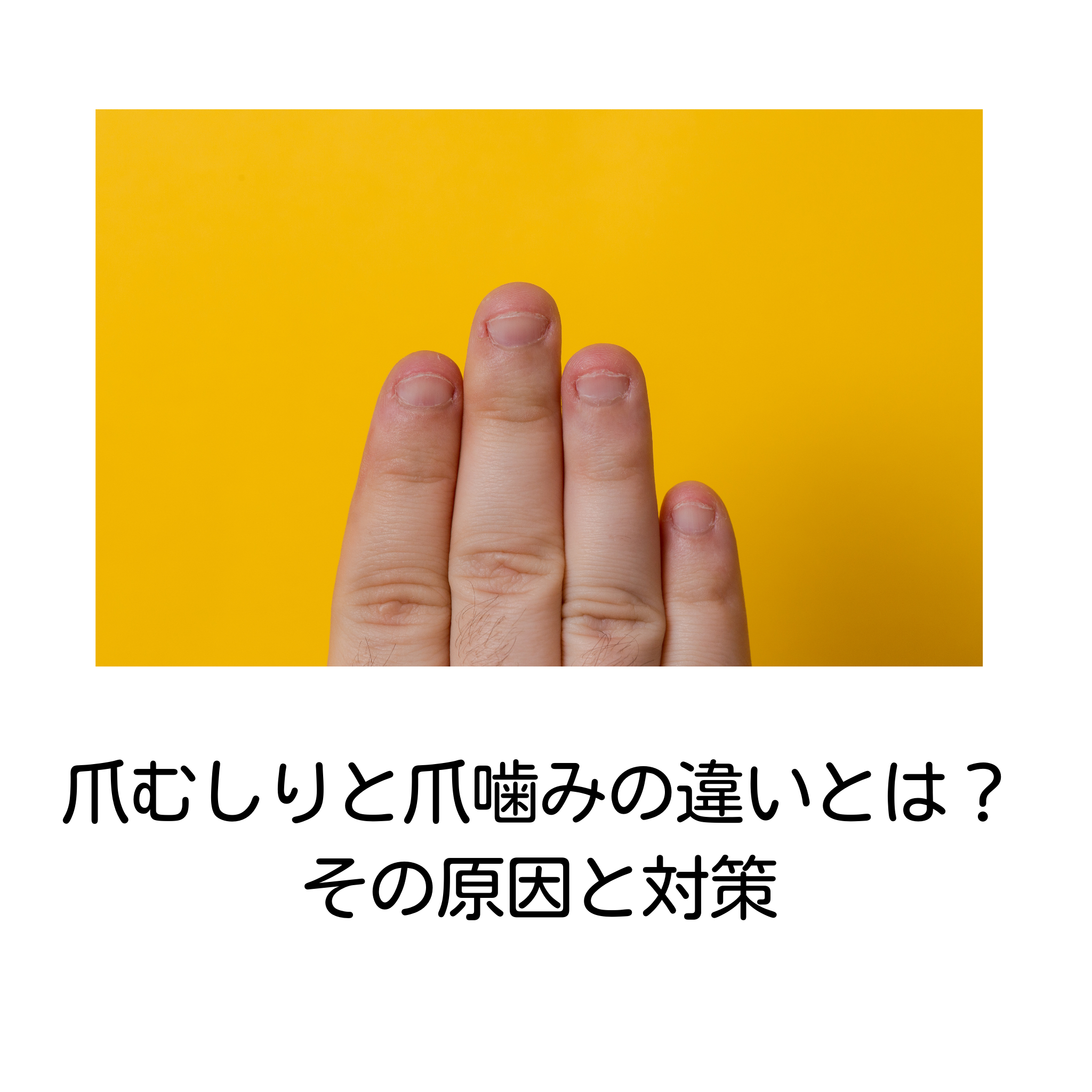 爪むしりと爪噛みの違いとは？その原因と対策