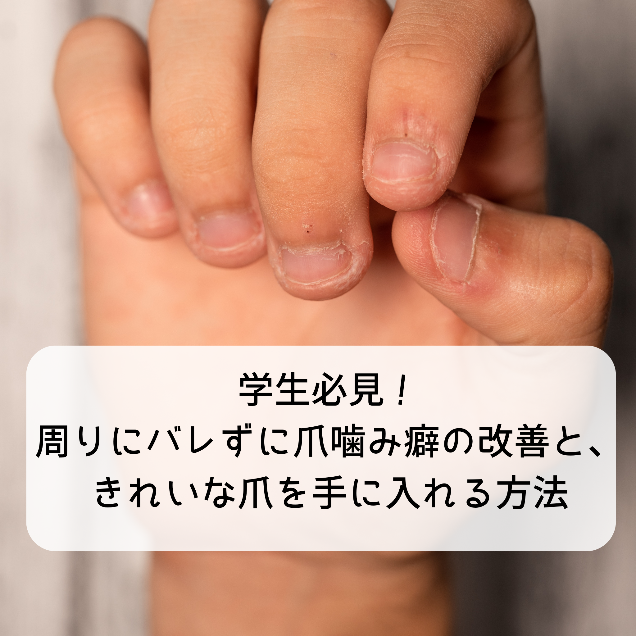 学生必見！周りにバレずに爪噛み癖の改善と、きれいな爪を手に入れる方法