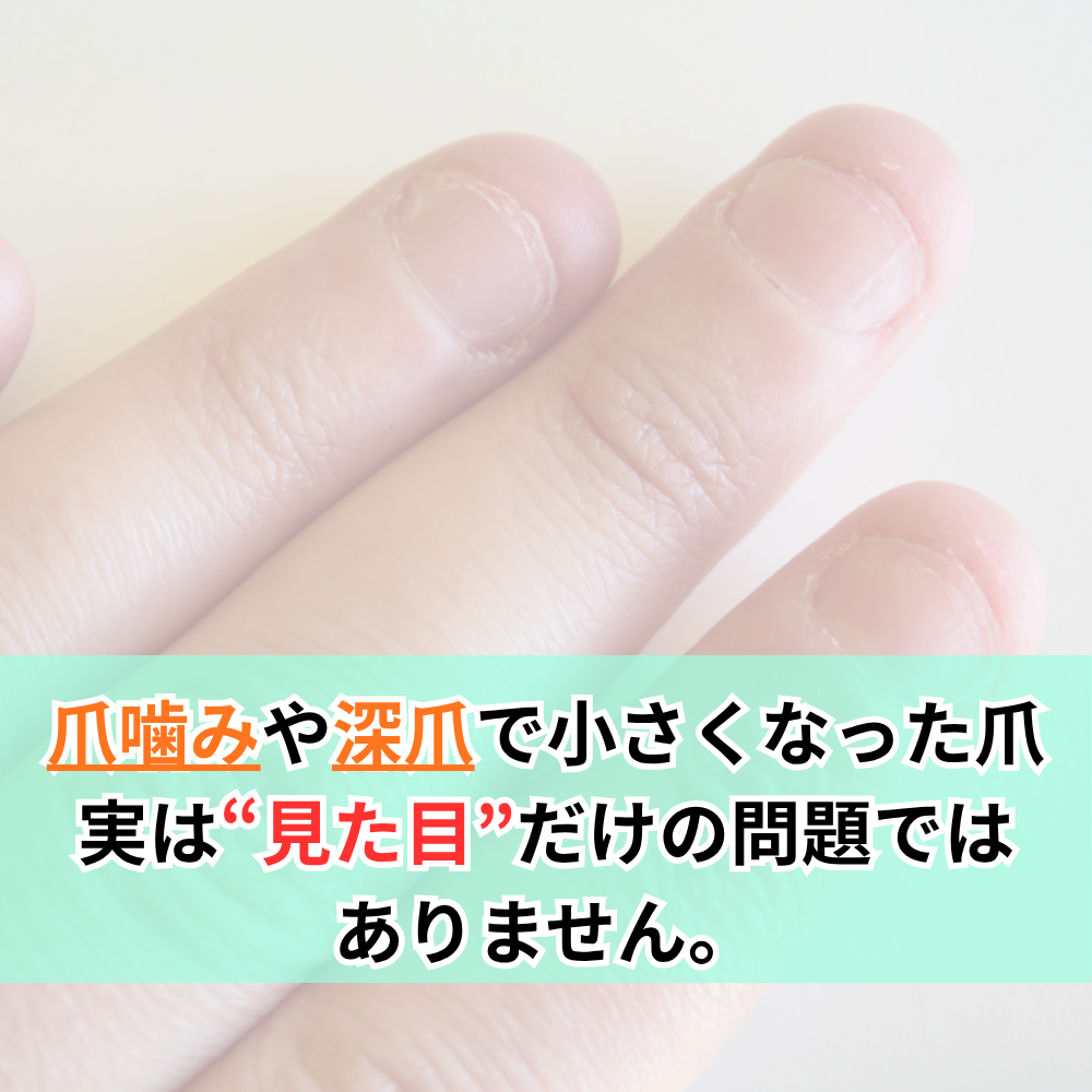 爪噛みや深爪で小さくなった爪——実は“見た目”だけの問題ではありません