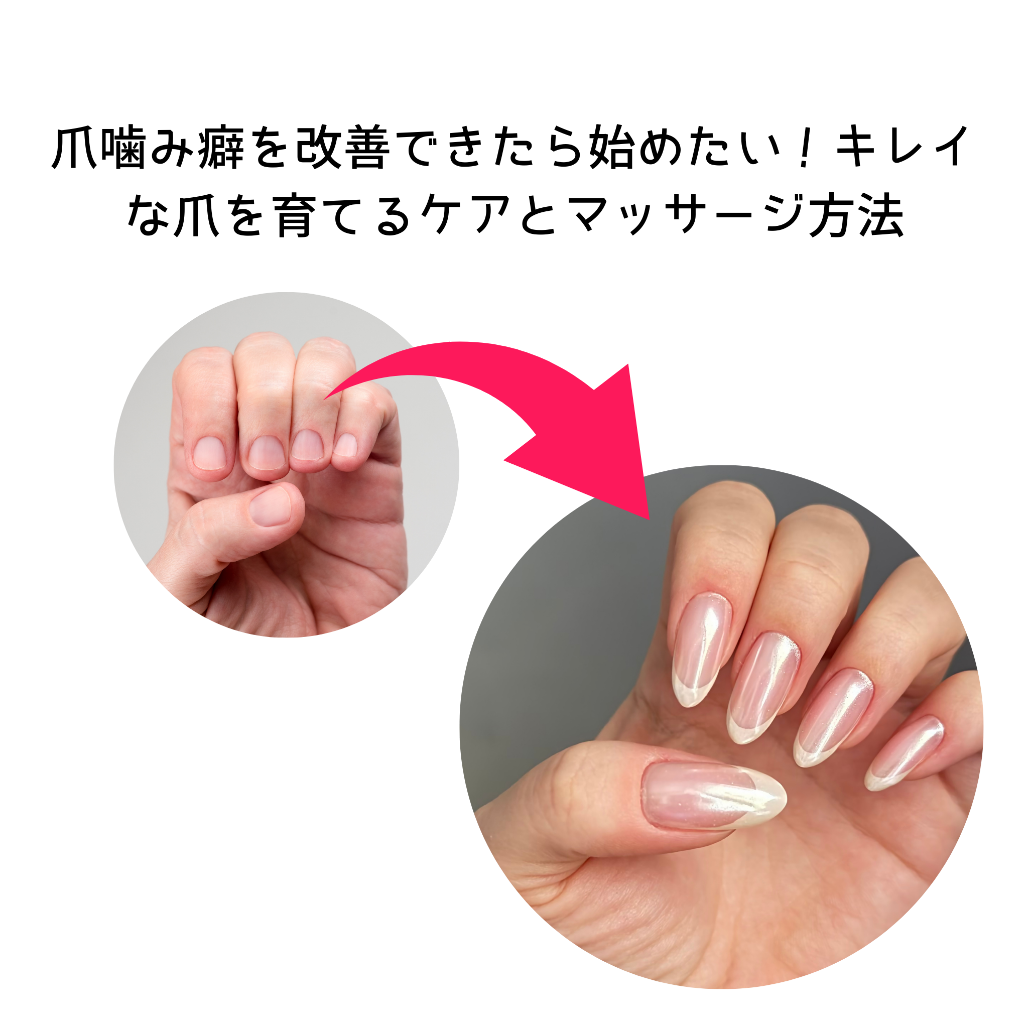 爪噛み癖を改善できたら始めたい！キレイな爪を育てるケアとマッサージ方法