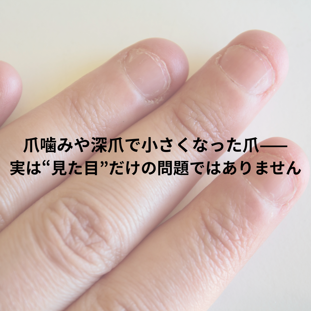爪噛みや深爪で小さくなった爪——実は“見た目”だけの問題ではありません