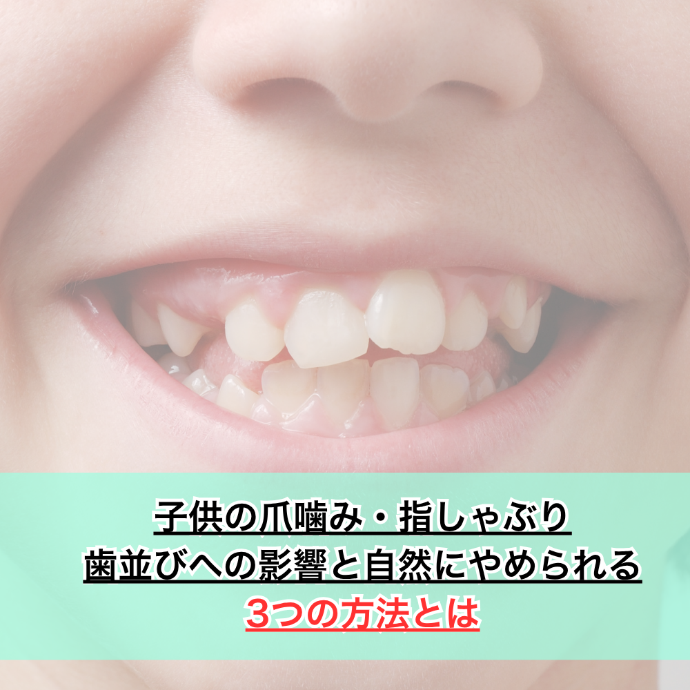 子供の爪噛み・指しゃぶりはいつまでにやめさせる？歯並びへの影響と自然にやめられる3つの方法とは