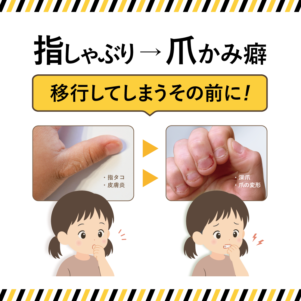【公式】子供の指しゃぶり防止に苦い日本製マニキュア “ちゅちゅピタ” 6ml