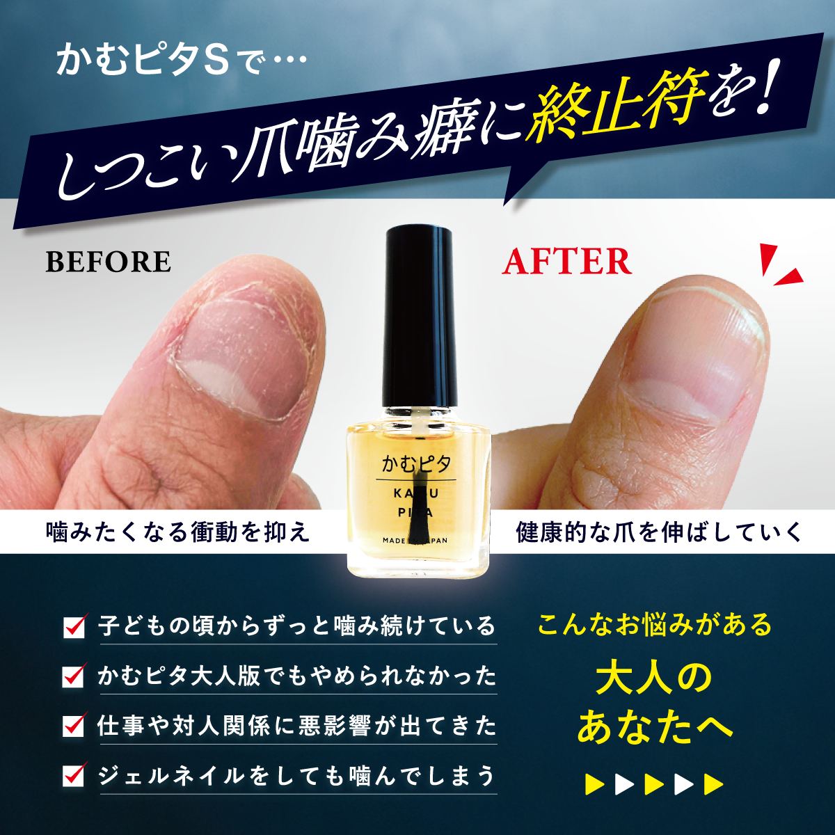 【公式】頑固で長引く爪噛み癖に最も苦いマニキュア “かむピタS” 6ml